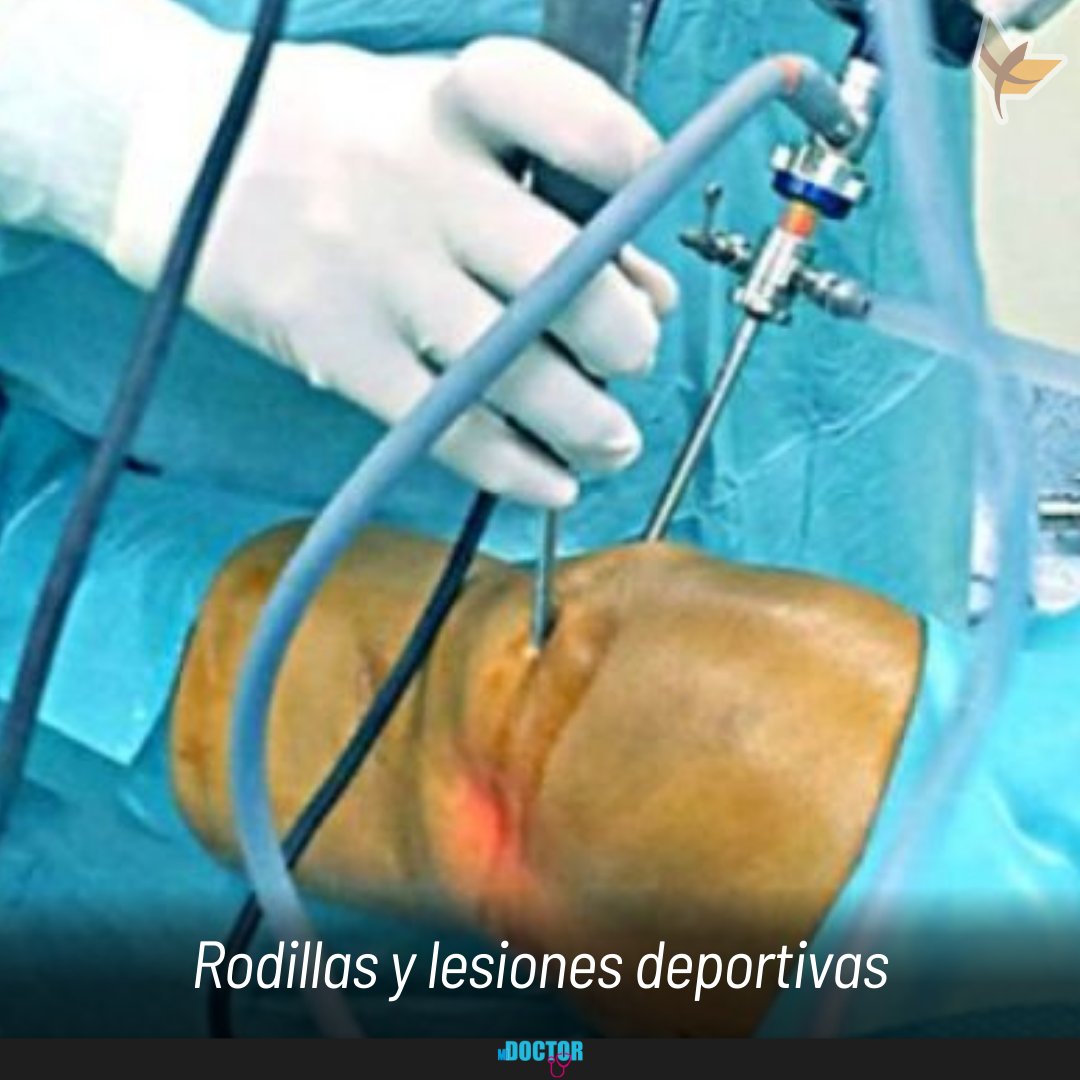 correodelsurcom's tweet photo. Aprende cómo se resuelven algunas de las lesiones más comunes entre deportistas, explicadas por el especialista de Artrocenter en #Sucre, Dr. Luis Antonio Goytia Alfaro en la edición dominical del suplemento #MIDOCTOR (Incluye Videos)

AUSPICIA:
@HPMedical

#RoturaDeLigamentos #lesióndelcartílagoarticular #lesionesdeportivas #Artrocenter

#SucreReferenteMédico