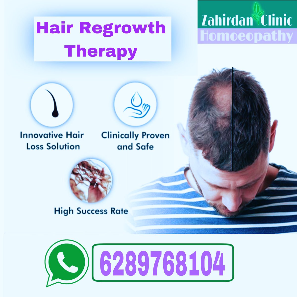 zahirdan's tweet photo. #zahirdanclinic #hairregrowth #hairregrowthtreatment #laserhairtreatment #hairlosstreatment #hairlosssolution #hairloss #hairlossproblem #hairlossspecialist #MPT #FPT #hairthinning #hairthinningsolution #hairthinningtreatment #hairthinningproblems #dhl #diffusehairloss https://t.co/33OSDX7cIU