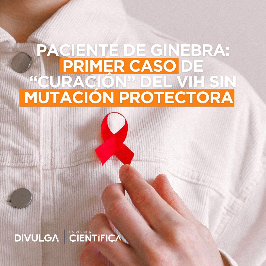 DivulgaUcsur's tweet image. En un avance sin precedentes en la lucha contra el VIH, se ha reportado el primer caso de &quot;curación funcional&quot; en una persona que no presenta la mutación genética CCR5 delta 32, conocida por ofrecer resistencia natural al virus.
#VIH #AvanceCientífico #TrasplanteDeCélulasMadre