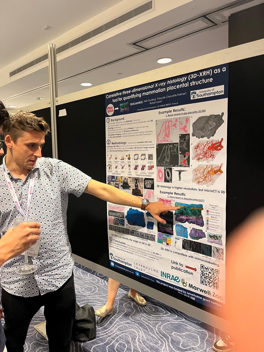 Rohan Lewis (@r_m_lewis) on Twitter photo Congratulations to <a href="/davislaundon/">Davis Laundon</a> for an amazing talk at IFPA in MontrΓ©al showing his work imaging placentas large and small to investigate what is necessary for successful pregnancy. <a href="/UoS_Medicine/">Southampton Medicine</a> Congratulations to <a href="/davislaundon/">Davis Laundon</a> for an amazing talk at IFPA in MontrΓ©al showing his work imaging placentas large and small to investigate what is necessary for successful pregnancy. <a href="/UoS_Medicine/">Southampton Medicine</a>