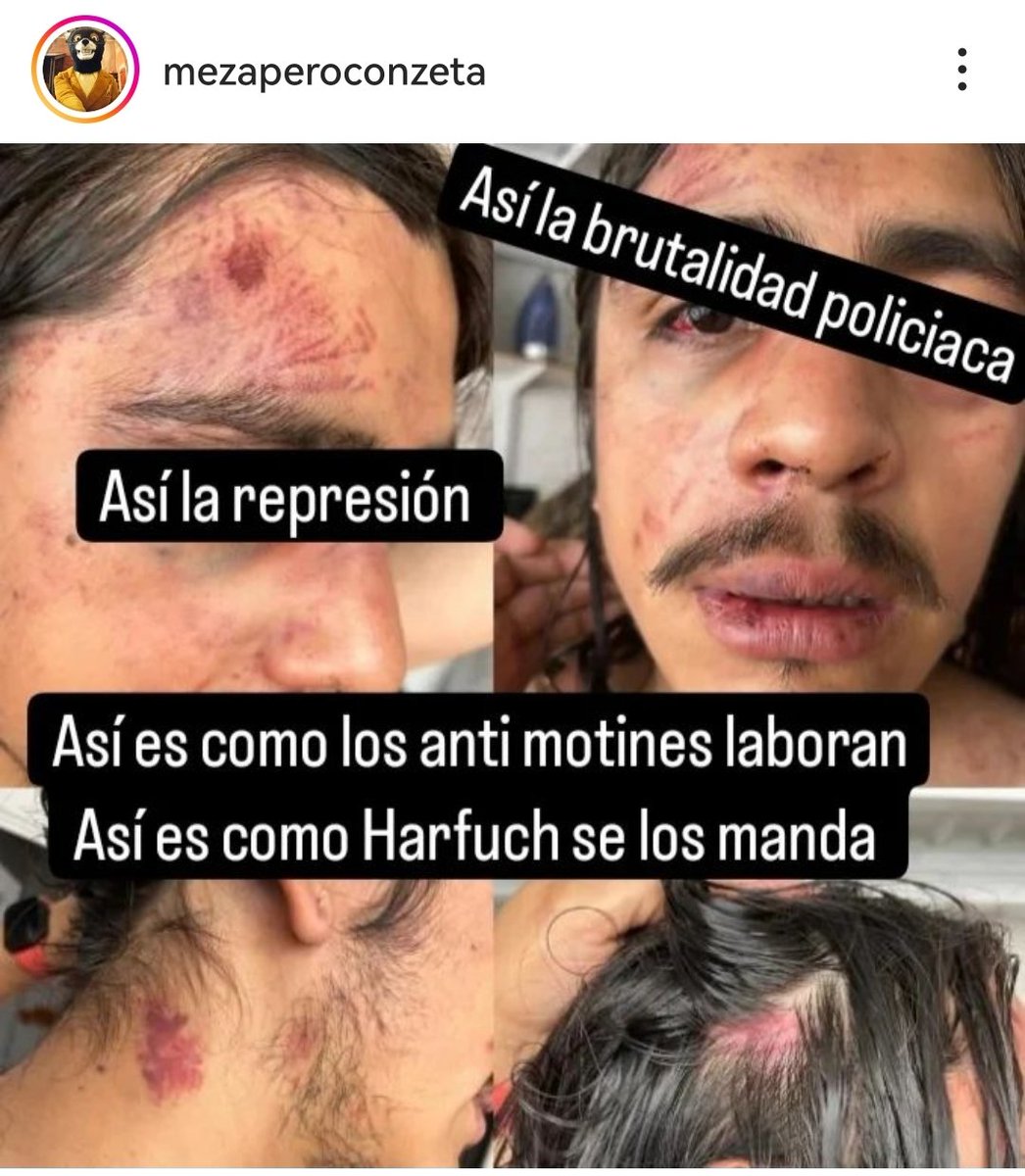 Me soltaron a los bots por las denuncias de ayer en #Xochimilco. Me tienen sin cuidado. Afortunadamente lo mío se queda en lo virtual. Pero hay compas que hoy la están pasando grave por la golpiza de grupos de choque y policías ayer.