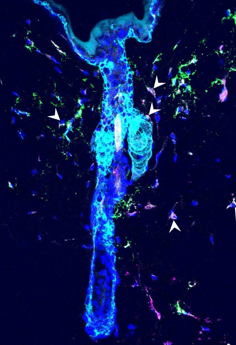 Elaine Emmerson tweet media