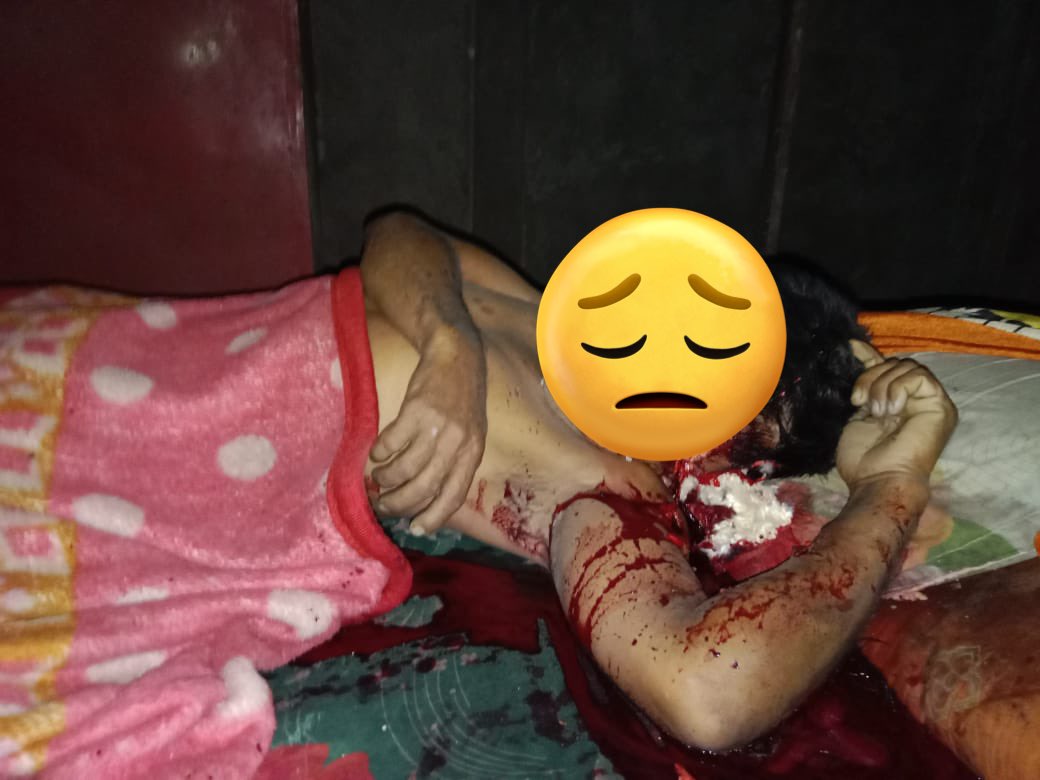 📍Jiribam, Manipur.
7 Sept, 2024.

Kuki Narco-Terrorists sneaked into the Meitei Village Nungchappi(Ningthem Khunou) and killed one Meitei when he was sleeping in the bed.

Security and safeguard of the common people is compromised in Jiribam.

<a href="/Spearcorps/">SpearCorps.IndianArmy</a> <a href="/official_dgar/">The Assam Rifles</a> <a href="/adgpi/">ADG PI - INDIAN ARMY</a>