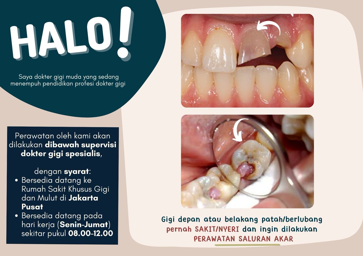 halo! kalau ada yang giginya pernah nyut nyut an atau ngilu dan tertarik untuk perawatan boleh dm aku yaa!

#koasgigi #PSA #sakitgigi #Gigi