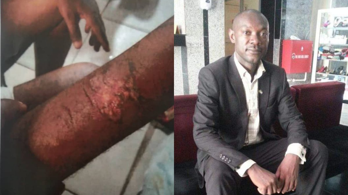 SaharaReporters's tweet photo. Police Brutalise, Arraign Enugu-based Activist In Court, Label Him IPOB Member For Exposing Corruption Among Top Officers | Sahara Reporters https://t.co/G9M9MurWS8 https://t.co/4AQctZrDE1