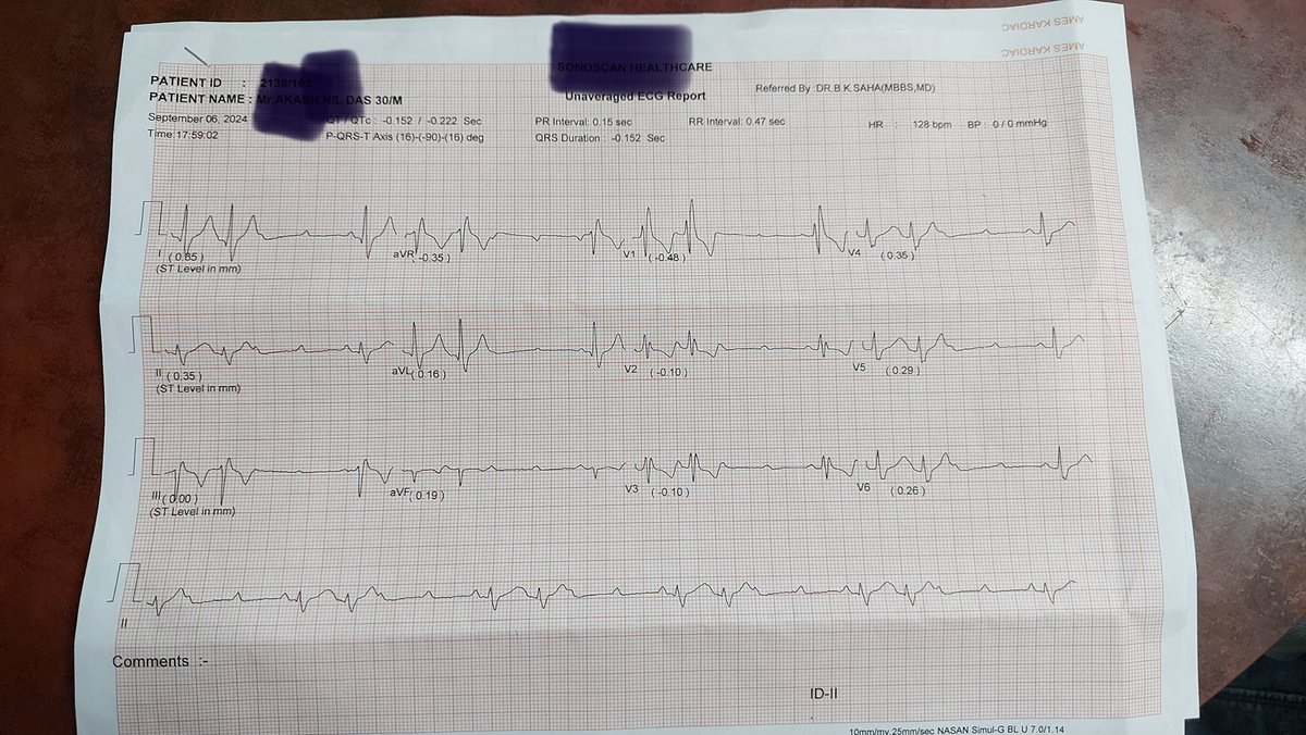 Joy Sanyal,MD, DM, (@joysanyal74) on Twitter photo 30 year male with first onset dizziness-no syncope-family history of pacemaker implantation-no known risk factors-what is the rythm <a href="/syamkumarmd/">Syamkumar</a> <a href="/SchakrabartiEP/">Shanta Chakrabarti</a> <a href="/DrRajeshG1/">Dr G Rajesh (Gopalan Nair Rajesh)</a> <a href="/DidlakeDW/">David Didlake</a> 30 year male with first onset dizziness-no syncope-family history of pacemaker implantation-no known risk factors-what is the rythm <a href="/syamkumarmd/">Syamkumar</a> <a href="/SchakrabartiEP/">Shanta Chakrabarti</a> <a href="/DrRajeshG1/">Dr G Rajesh (Gopalan Nair Rajesh)</a> <a href="/DidlakeDW/">David Didlake</a>