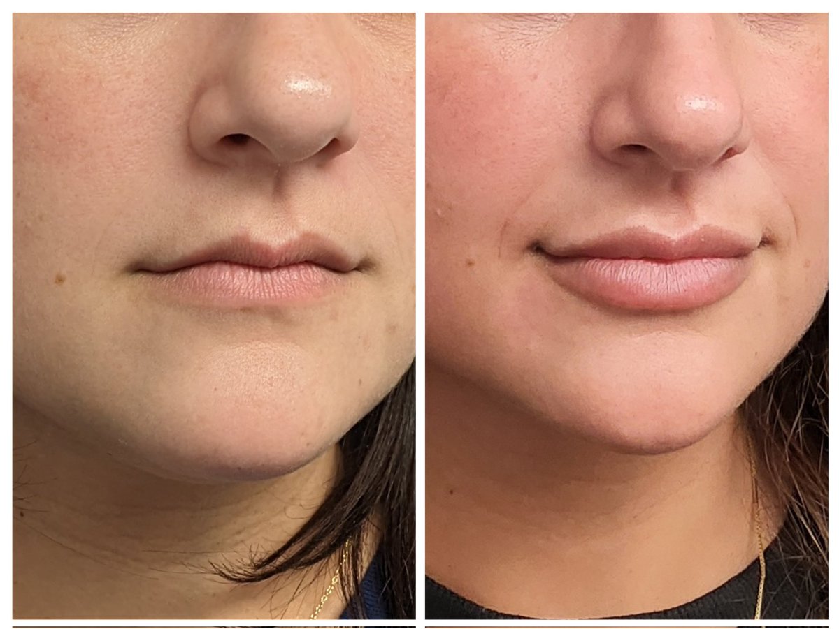 HighPointMedSpa tweet picture