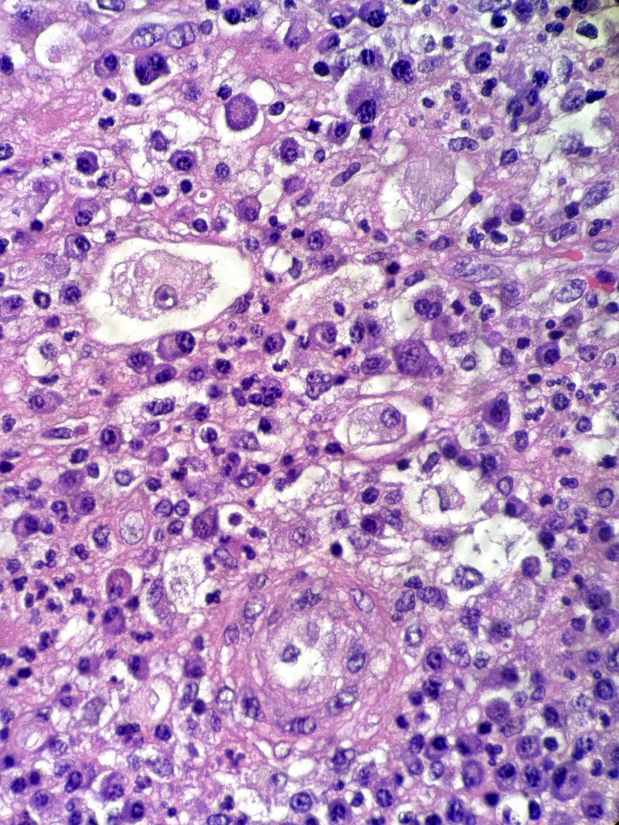 Gianni Ippoliti tweet media