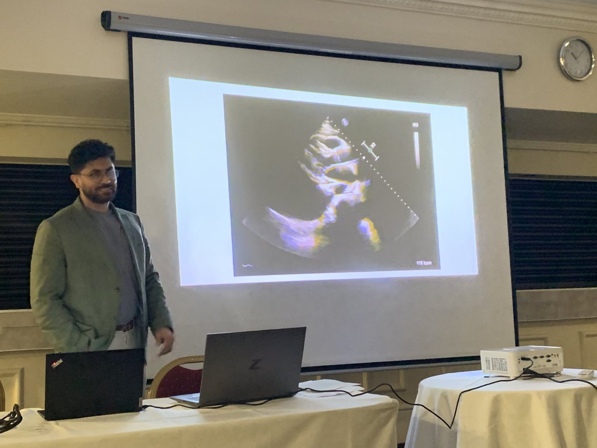 Sarb Clare MBE (@acutemedsarbc) on Twitter photo Thankyou <a href="/prabskaur_/">prabs</a> for arranging a brilliant foundation Echo course ! <a href="/BSEcho/">BSEcho</a> <a href="/AmyBroad92/">Amy Broad</a> <a href="/WaseemKhamboo/">Waseem Khamboo</a> <a href="/SharjeelKiani1/">S Z Kiani</a> <a href="/m40nav/">Naveed Saeed</a> A fantastic faculty with great images and patient stories ! The Power of POCUS <a href="/GeneralistUS/">Ultrasound For The Generalist</a> ☺️ Thankyou <a href="/prabskaur_/">prabs</a> for arranging a brilliant foundation Echo course ! <a href="/BSEcho/">BSEcho</a> <a href="/AmyBroad92/">Amy Broad</a> <a href="/WaseemKhamboo/">Waseem Khamboo</a> <a href="/SharjeelKiani1/">S Z Kiani</a> <a href="/m40nav/">Naveed Saeed</a> A fantastic faculty with great images and patient stories ! The Power of POCUS <a href="/GeneralistUS/">Ultrasound For The Generalist</a> ☺️