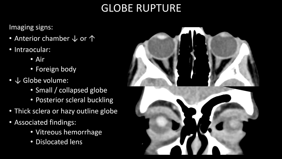 American Society of Pediatric Neuroradiology tweet media
