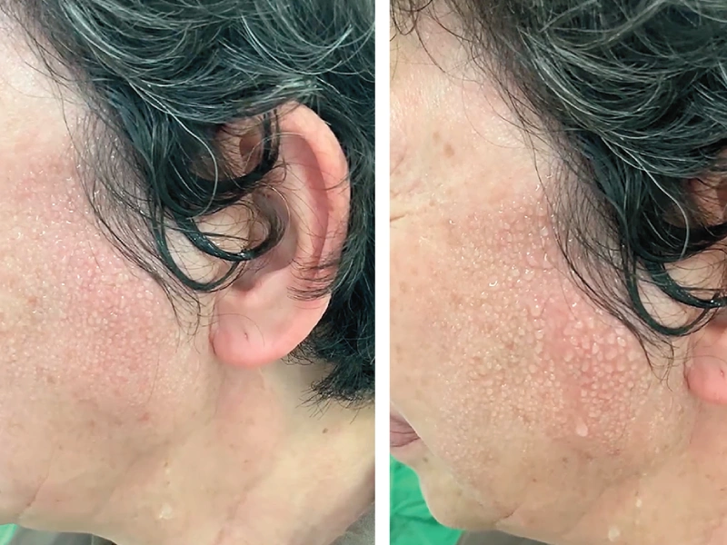 Juan C Ivancevich MD tweet media