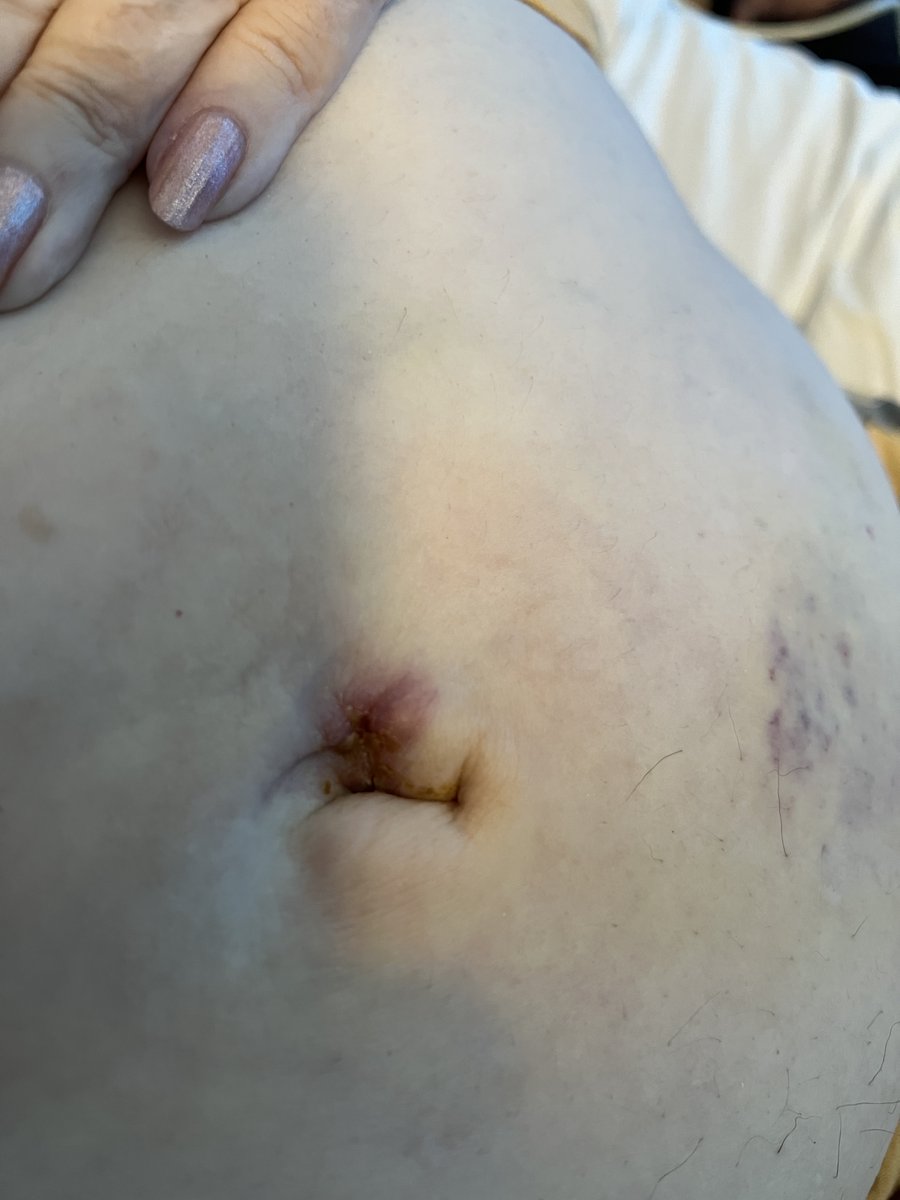 Keith Siau tweet media