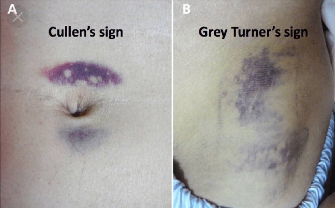 Keith Siau tweet media