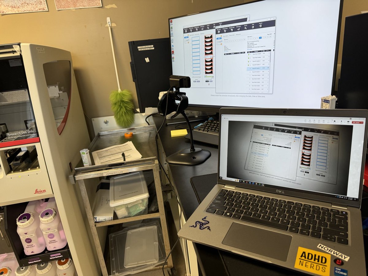 Sometimes the best ideas come on rainy Saturdays. Troubleshooting a heating pad temperature issue and temperature isn’t recorded (only shown onscreen). So I’ve now set up a webcam using teams!
#BOND24hrpeepshow