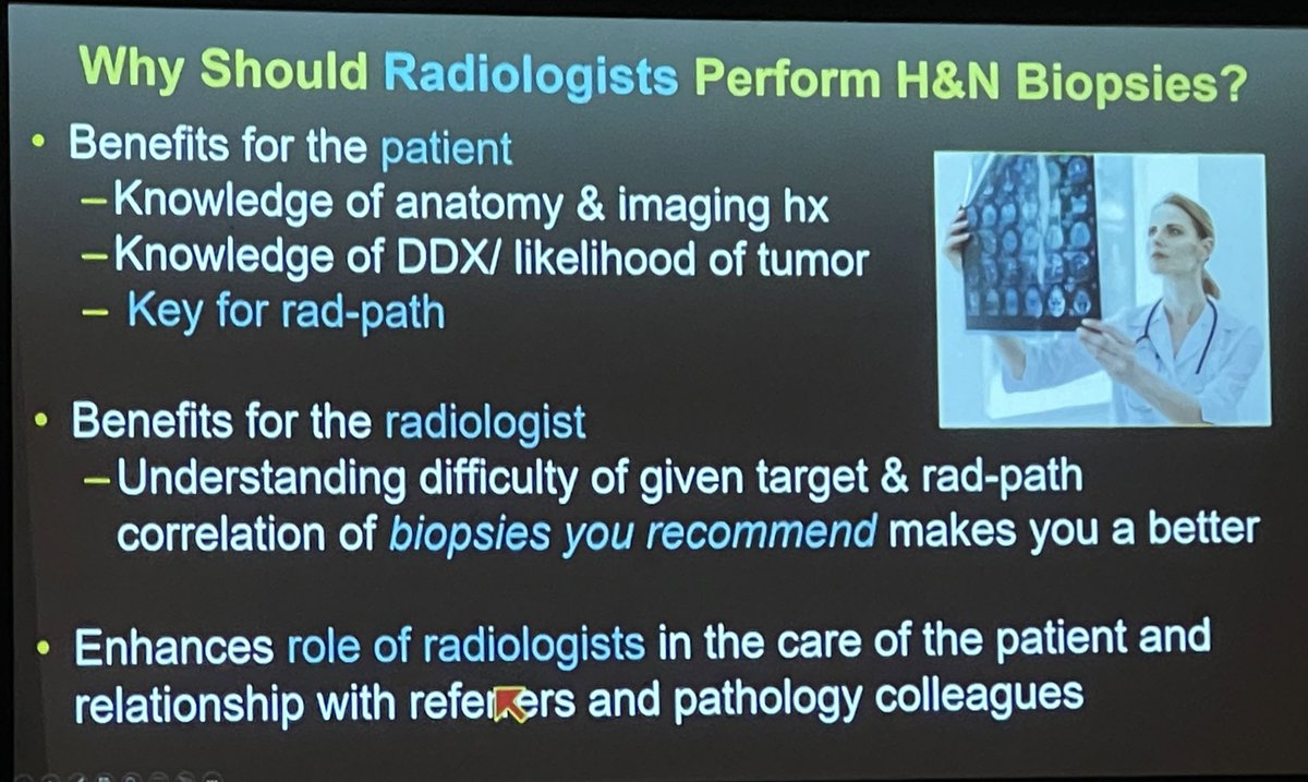 GelbmanM's tweet photo. Many ways for H&N rads to add value in H&N cancer treatment from @ENThawk
Proper use of #NIRADS classification for follow ups and guiding management, radiologist involvement with biopsies, daily mini tumor boards etc.
#ENT #radiology #ASHNR24 https://t.co/M5W0ROjlXx