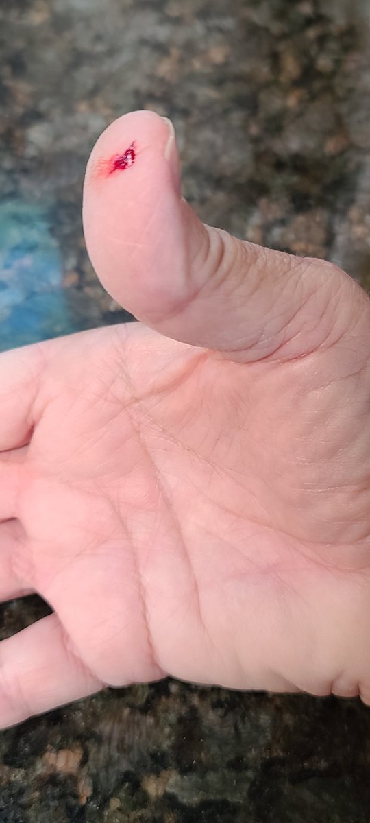SWDesertLiving's tweet photo. No good deed go unpunished.  Saved it from being stuck in the fence and it bit me. #desertliving #sonorandesert #tucsonaz #desertlife #sonorandesertcritters #arizonadesert #coachwhipsnake #biteysnakes #arizonawildlife #tucsonwildlife #snakes #watchwhereyouwalk #coachwhipsnakes https://t.co/6j3nlQKWF9