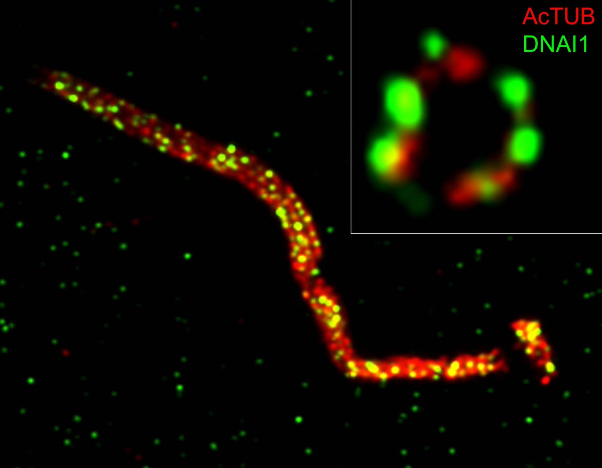 You don’t wanna know how much antibody this project took - totally worth it, every last drop.  biorxiv.org/content/10.110… Expansion microscopy of axonemal dyneins in islet primary cilia