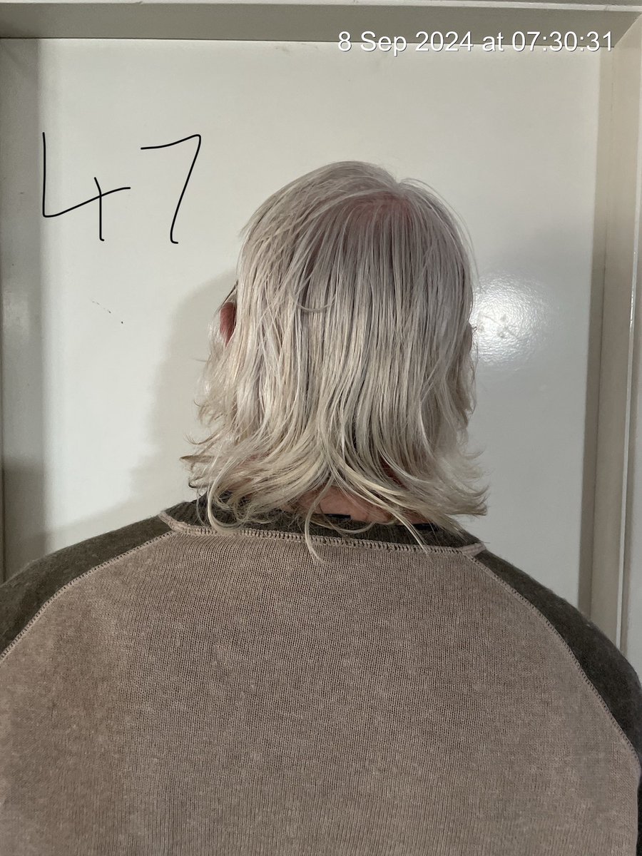 Mickysch68's tweet photo. https://t.co/zxOfz99W8R
https://t.co/07dUHjEAG8
https://t.co/9SfyR3DKJ3
Tam Oz Tag
Brba Shp 2340-Joblink Plus
W 47 hair https://t.co/gNRMBtVVZm cut/shve 12 mnths,14 Oct 24 fin date.Ech prsn 2 dnate  drawn cn win prize
#shavehairforcharity #12monthsnoshavenocut #growhairforcharity https://t.co/zvm8lISiY7