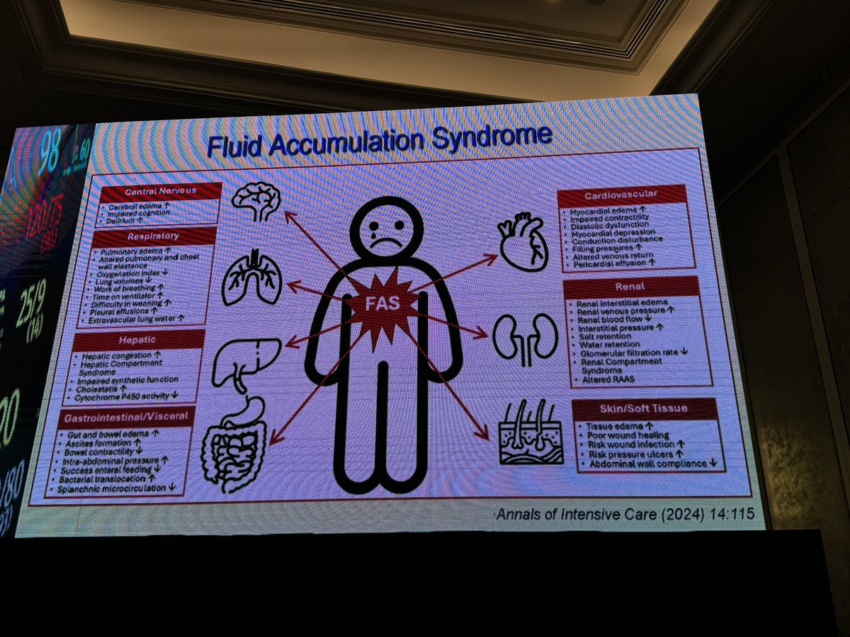 ChinSeng_Gan's tweet photo. Dr Sheila Myatra cuationed us DO NOT over relying on the fluid tolerance but stop/ slow down fluid when there is less fluid responsiveness or there is risk of complications. Passive leg raising test is a hood dynamic bedside test #ASMIC2024 #pedsicu https://t.co/lMBKLUMw49