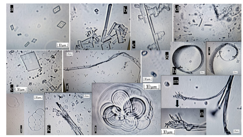 DrShem's tweet photo. Real-Time Self-Assembly of  Stereomicroscopically Visible Artificial Constructionsin Incubated Specimens of  mRNA Products Mainly from Pfizer and Moderna: A Comprehensive Longitudinal Study

https://t.co/iVa9BjoB1i https://t.co/sNZm27SLMl