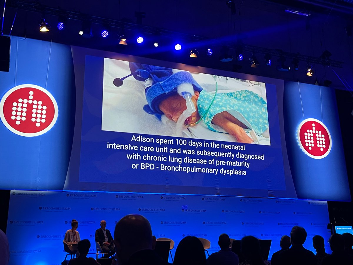 Denby Evans (@denby_evans) on Twitter photo So exciting to finally see a dedicated session on prematurity associated lung disease at the #ERSCongress
A full audience for the great talks by Amber Bates (<a href="/TinySparksWA/">Tiny Sparks WA</a>), Anna Lavizzari, Sailesh Kotecha, <a href="/DrLungSimpson/">Shannon Simpson</a> and <a href="/DuijtsL/">Liesbeth Duijts</a> So exciting to finally see a dedicated session on prematurity associated lung disease at the #ERSCongress
A full audience for the great talks by Amber Bates (<a href="/TinySparksWA/">Tiny Sparks WA</a>), Anna Lavizzari, Sailesh Kotecha, <a href="/DrLungSimpson/">Shannon Simpson</a> and <a href="/DuijtsL/">Liesbeth Duijts</a>