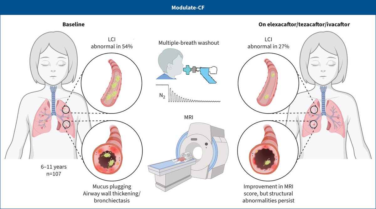European Respiratory Journal: LCI and MRI detect rapid and sustained improvement of CF lung disease in school-aged children following initiation of ETI bit.ly/3wR4LWj