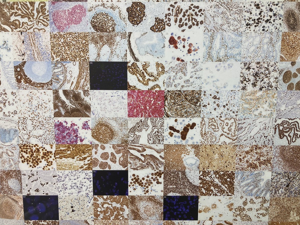 Come and see us today on booth 95 at the #ECP2024 #Florence. We have experts in Immunocytochemistry &amp; In-Situ Hybridisation here and happy to help <a href="/ukneqasicc/">UK NEQAS ICC & ISH</a>. New programmes also available #Melanoma markers, #Sarcoma  markers.