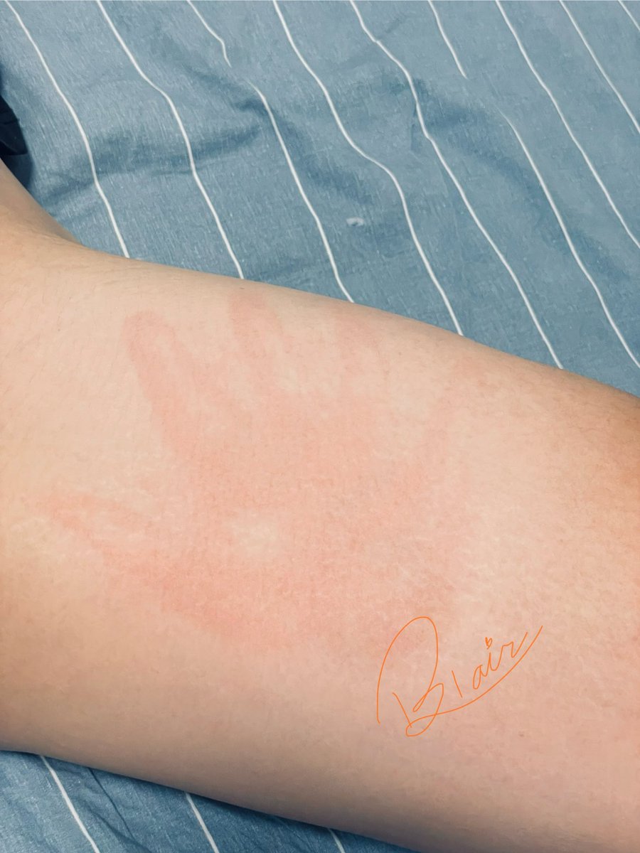 是我的小手收🧡