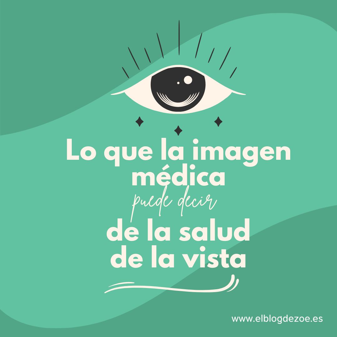 melzbentue's tweet photo. Alejandra Consejo lleva 10 años investigando sobre enfermedades de la vista #degeneraciónmacular #glaucoma #cataratas...
Ahora, el @ERC_Research le ha concedido financiación para poner en marcha su proyecto VISIONSAFE.
Puedes leerlo en #ElBlogdeZoe
🗞📹https://t.co/WRErkIBiYS https://t.co/vS3gpQDsWq