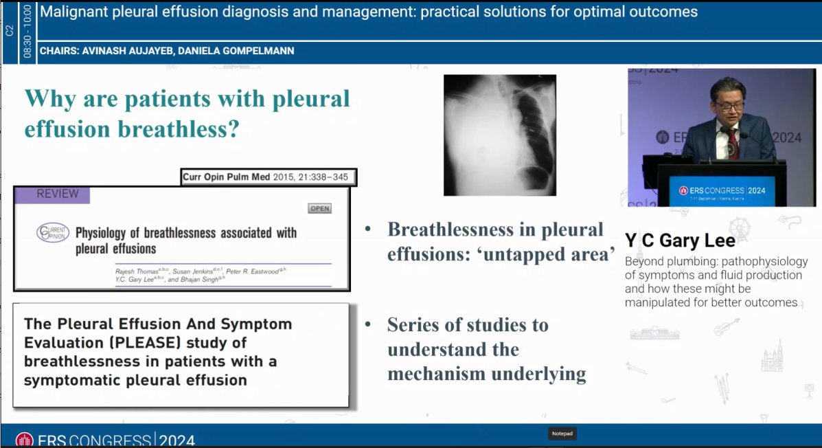 Great Sunday symposium on MPE ,began with legendary <a href="/naj_rahman/">Najib M Rahman</a> ,with closing talk by Prof <a href="/YCGaryLee/">Y C Gary Lee</a> . Gary Lee

Talking about bypassing aspiration to direct biopsy approach, optimal pathways and assessing breathlessness in MPE cases

#ERSCongress 2024 ,European respiratory