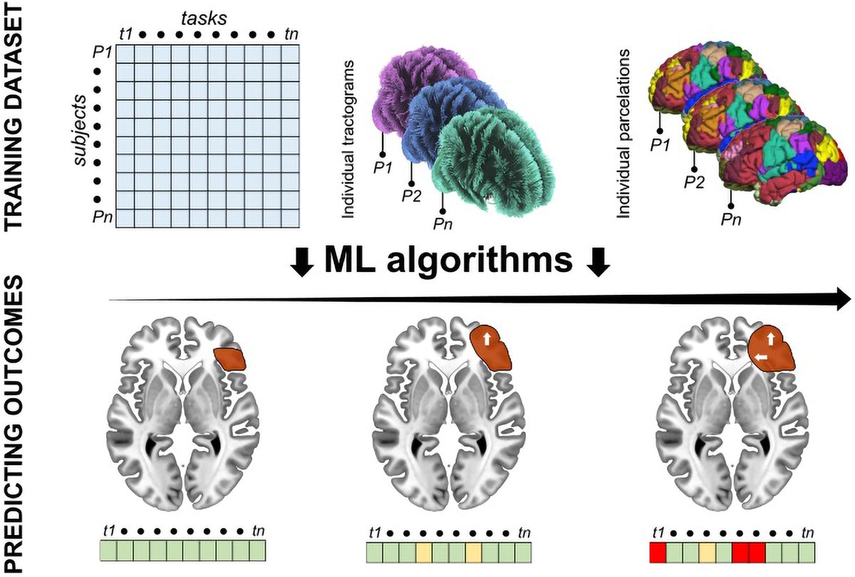 Herbet et al. examine how machine learning algorithms can be used during presurgical planning to predict cognitive outcomes following glioma resection. tinyurl.com/y6pvdt94