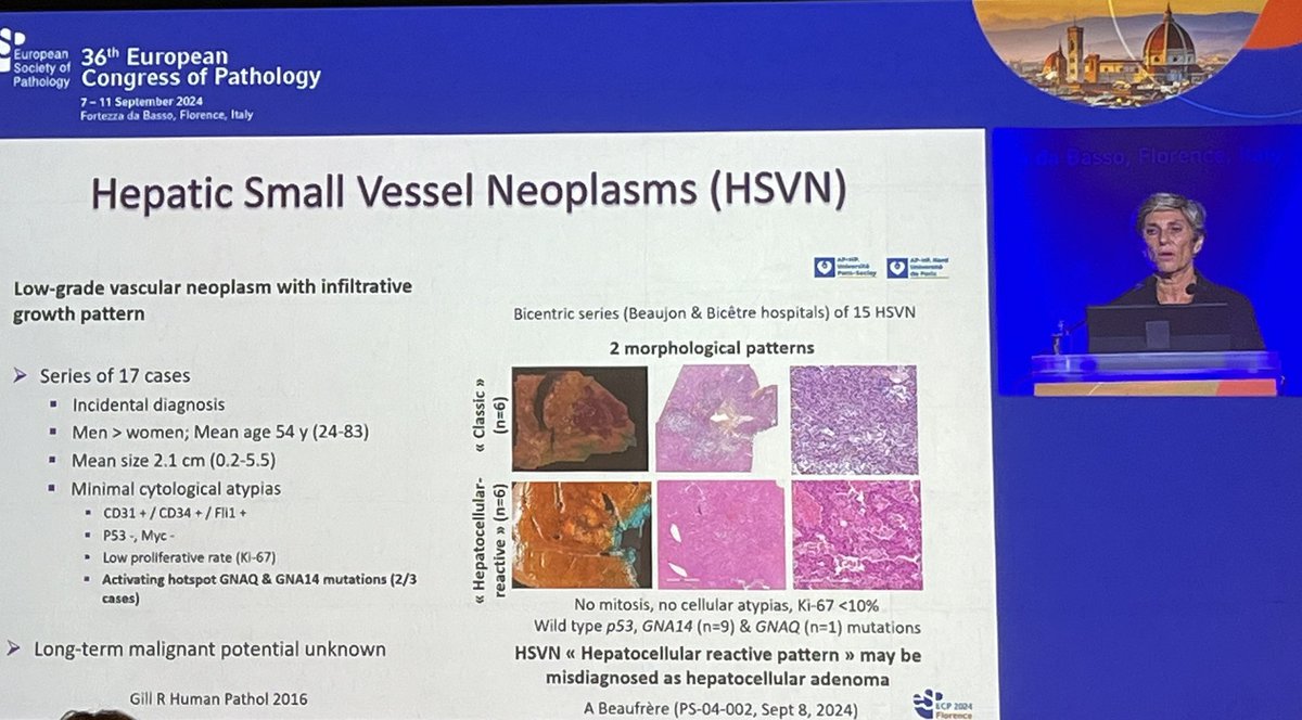Dina Tiniakos (@dinatiniakos) on Twitter photo Who better than @valerparadis to tackle with ease the differential diagnosis of non-epithelial liver tumours🔬🧬! #ECP2024 <a href="/ESP_Pathology/">European Society of Pathology (ESP)</a> <a href="/EASLnews/">EASLnews</a> <a href="/UKLiverPath/">UK Liver Pathology Group</a> <a href="/LiverPath_HPHS/">Hans Popper Hepatopathology Society</a> Who better than @valerparadis to tackle with ease the differential diagnosis of non-epithelial liver tumours🔬🧬! #ECP2024 <a href="/ESP_Pathology/">European Society of Pathology (ESP)</a> <a href="/EASLnews/">EASLnews</a> <a href="/UKLiverPath/">UK Liver Pathology Group</a> <a href="/LiverPath_HPHS/">Hans Popper Hepatopathology Society</a>