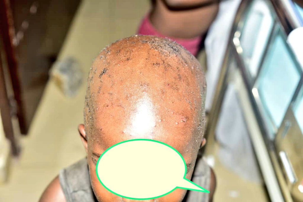 msp_burundi's tweet photo. Le Ministre se réjouit de la meilleure prise en charge des patients, de la qualité de l'organisation du centre de prise en charge(#hygiène, disponibilité des #intrants et l'alimentation des patients par ce centre...),de l'engagement du personnel et de la satisfaction des patients https://t.co/0etpdrujoQ