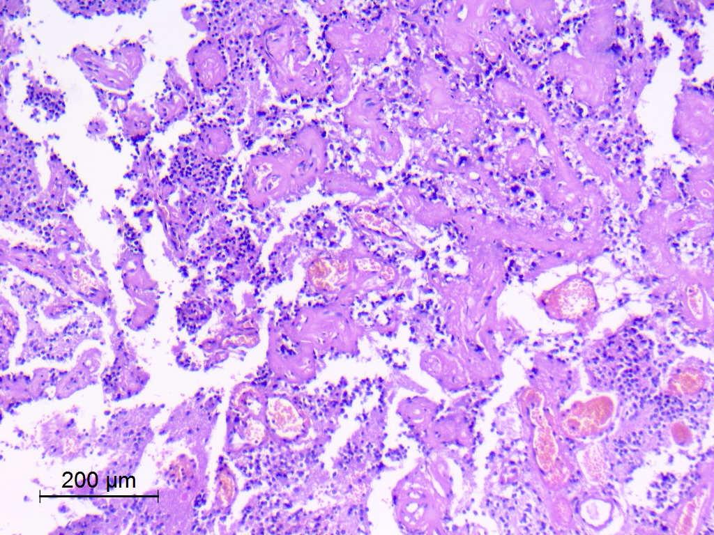 CuringN's tweet photo. CNS & pituitary tumors - What's your diagnosis?
Topic link: https://t.co/WcevVetxZ7
Images contributed by Eman Abdelzaher, M.D., Ph.D.
Visit our CCN blog for Dr. Pernick's cancer-related essays: https://t.co/aaLBk9BA8J.
#Cancer #CancerResearch #CuringCancerNetwork #Pathology https://t.co/4YPD0bq97A
