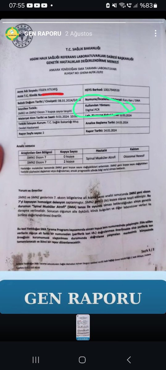 TOPUK KANI ALDIKLARI BEBEKLERİN (SMA) OLUP OLMADIĞINI; (PCR) TESTİ İLE BELİRLİYORLARMIŞ!!!!!!

DURUMUN VAHAMETİNİ ANLAMAK  İÇİN BAŞKA ŞEYE GEREK VAR MI?