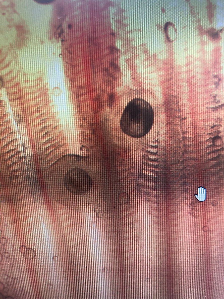 Elvira de Eyto (@edeeyto) on Twitter photo Glochidia of Margaritifera (Freshwater Pearl mussels) attaching onto our hatchery salmon 🤩🤩 this week
Love to see it ❤️💚
<a href="/MarineInst/">Marine Institute</a> <a href="/NPWSIreland/">National Parks and Wildlife Service</a> Glochidia of Margaritifera (Freshwater Pearl mussels) attaching onto our hatchery salmon 🤩🤩 this week
Love to see it ❤️💚
<a href="/MarineInst/">Marine Institute</a> <a href="/NPWSIreland/">National Parks and Wildlife Service</a>