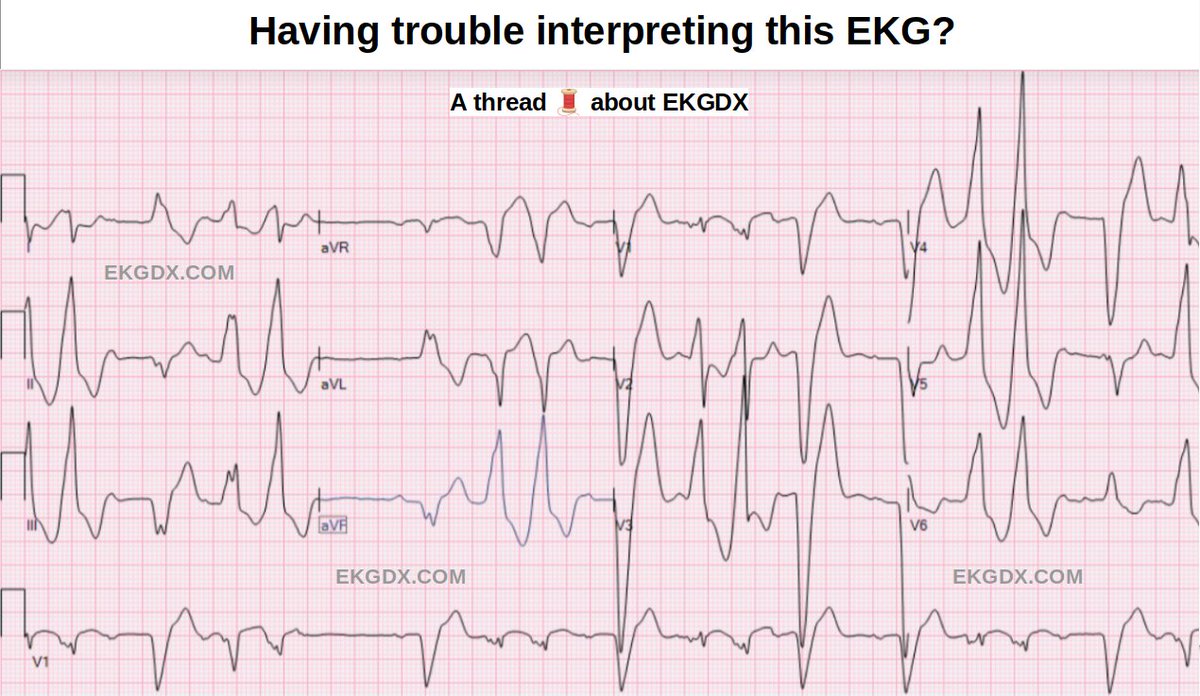 1/ Today's 🧵is about EKGDX. 

The purpose of this thread is to share some data and achievements about an online educational platform on EKG, which is becoming popular among the new generations (younger people).

<a href="/ekgdx/">EKGDX</a> #ekgdx #ecg