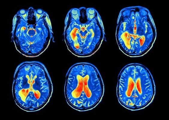 thesigmamindset's tweet photo. I'm 27

Stress controlled me for years so I turned to neuroscience.

After 1200+ hours studying elite athletes, CEOs &amp; psychologists, my toolkit is now full of powerful neuro-hacks.

Here are the top 7 that will change your life: https://t.co/C2DOdN27k8