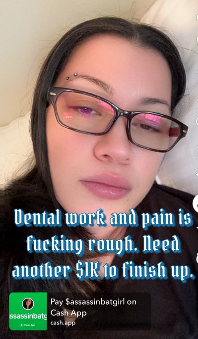 🤕 https://t.co/baQ28YS8D8<a href="/tag/manyvids"class="tags"><span>#manyvids</span></a>