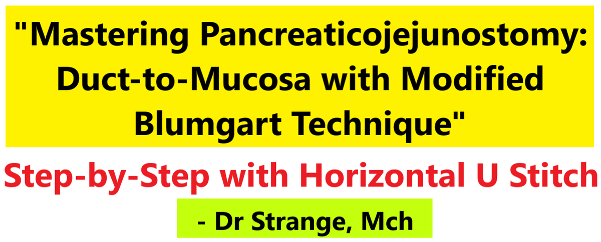 drvipan's tweet image. #WhippleProcedure #Pancreaticojejunostomy 
Coming Soon:Mastering Pancreaticojejunostomy: Duct-to-Mucosa with Modified Blumgart Technique 
Links to the earlier videos are below. Stay tuned!
Thanks &amp;amp; Regards.
On App - classplusapp.com/w/dr-strange-m…
On YouTube - youtube.com/playlist?list=…