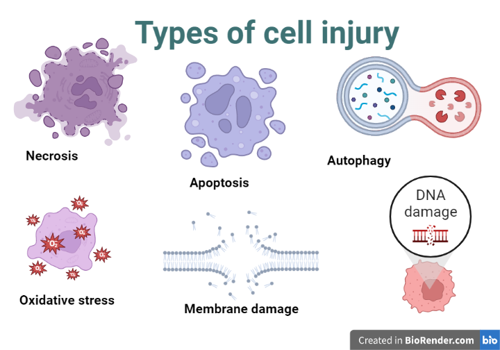 SCIENCEVIVID2's tweet photo. Cell injury is a term used to describe any type of damage or harm that occurs to a cell. This can be caused by a variety of factors, including physical damage, chemical damage, or biological damage.
https://t.co/EvXHvbkIZj https://t.co/qtSEJAIvq7