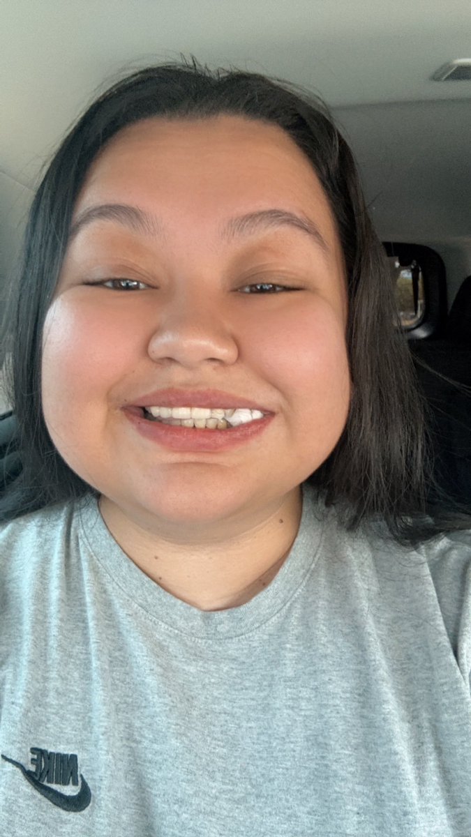 CurtisteiAndra's tweet photo. Funny life update: I got a wisdom tooth, and a root canal taken out today. I took this pic cause I felt like I looked like a chipmunk 😂😂 https://t.co/MhJuLelKhE