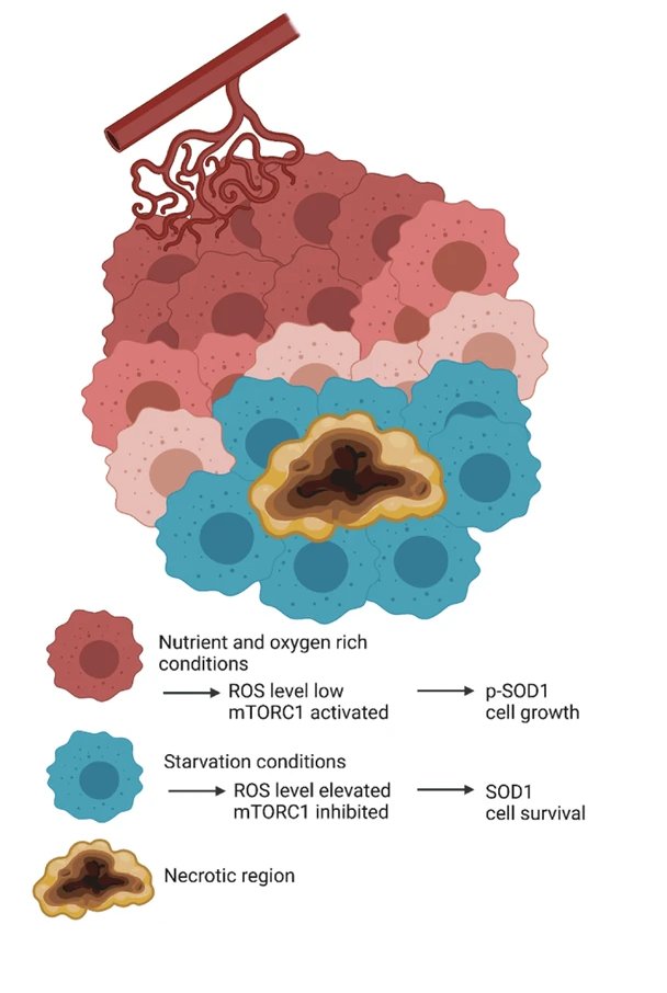 Extracellular Matrix News (@extracellmatrix) on Twitter photo Researchers from <a href="/FCI_health/">Frankfurt Cancer Institute</a> report that genetic and pharmacological inhibition of SOD1 leads to sensitization to hypoxia-induced cell death 💀 and disruption of redox balance under conditions of the #glioma microenvironment.
go.nature.com/3XoOnH2 Researchers from <a href="/FCI_health/">Frankfurt Cancer Institute</a> report that genetic and pharmacological inhibition of SOD1 leads to sensitization to hypoxia-induced cell death 💀 and disruption of redox balance under conditions of the #glioma microenvironment.
go.nature.com/3XoOnH2
