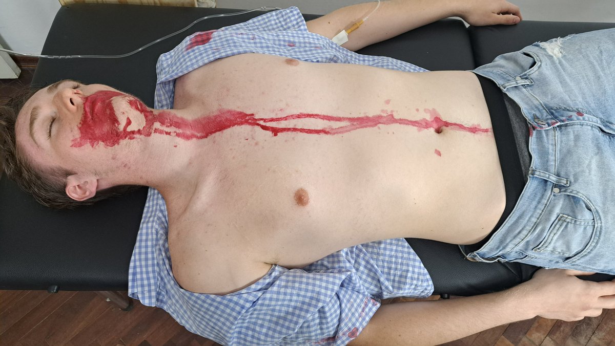NickCpranddefib's tweet photo. Sebastian is brought to the doctor's office after vomiting blood at a party. He flatlines and has to be revived with help.
Unfortunately, he doesn’t recover.
Preview: https://t.co/q7UA7Z6CFt
Full version $14.90

#party #friends #blood #resus #cpr #ambubag #defib #doctor #patient https://t.co/mhXJ57tOcT