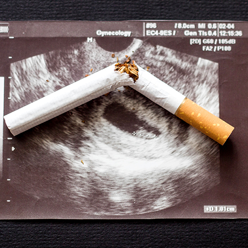 #Smoking harms almost every part of your body. But if you smoke when #pregnant, the toxic chemicals in #tobacco will also harm your unborn #baby, as new <a href="/UniversitySA/">UniSA</a> #research shows that it could lead to reduced academic outcomes at #school. brnw.ch/21wM7VE