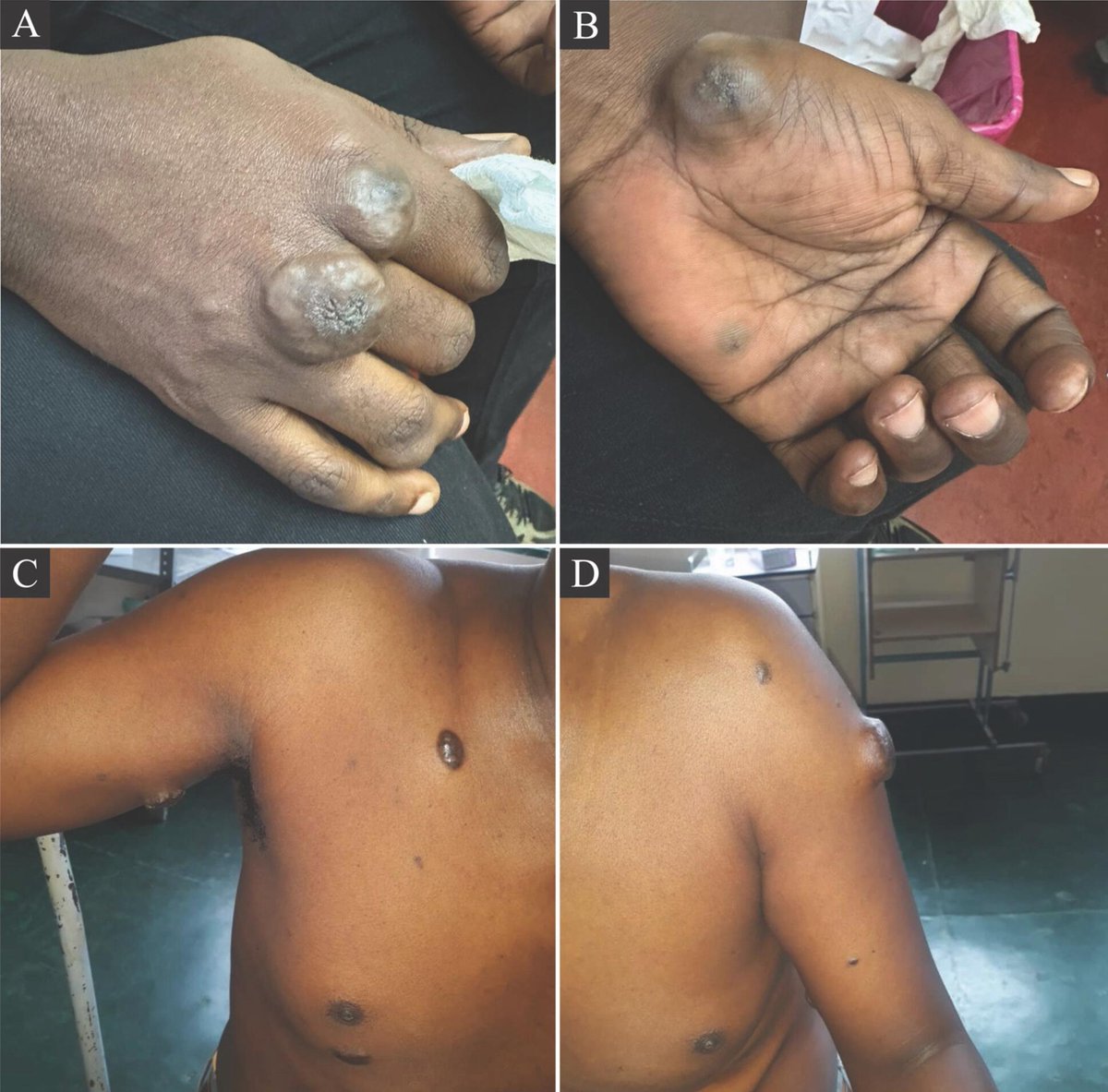 Frontline Gastro tweet media