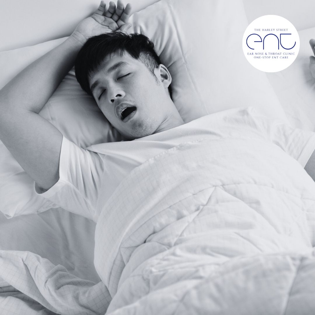 HarleySt_Ent's tweet image. At Harley Street ENT, our specialists can help diagnose and treat snoring effectively. 

We&apos;ll start with a thorough examination and may suggest lifestyle changes.  

Have you tried any lifestyle changes to reducing snoring?

#Snoring #SnoringProblem #HarleyStreetENT