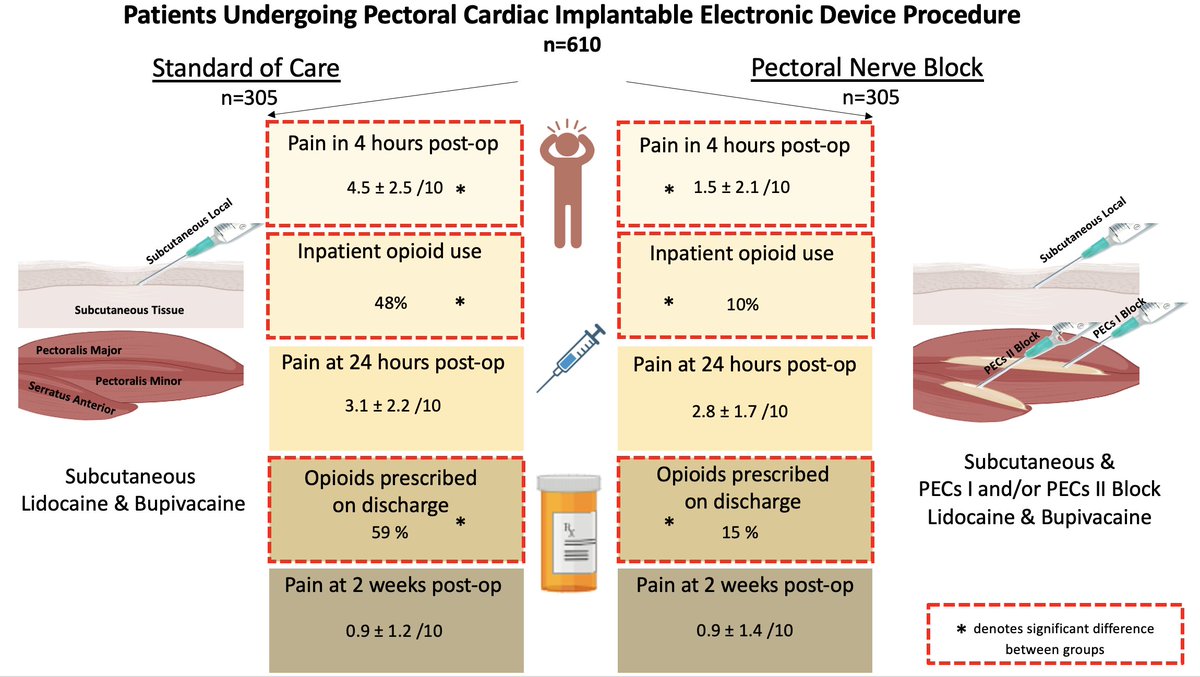 Timothy Markman (@dr_markman) on Twitter photo #EPeeps Your patients may have significant pain after CIED procedures. Out in <a href="/hrs_journal/">HeartRhythm</a> - EP performed PECs block is easily be added to work flow of standard implant with reduction in pain & post-op opioid requirements. <a href="/PennMedicine/">Penn Medicine</a> <a href="/PennEPFellows/">Penn Electrophysiology Fellowship</a>
sciencedirect.com/science/articl… #EPeeps Your patients may have significant pain after CIED procedures. Out in <a href="/hrs_journal/">HeartRhythm</a> - EP performed PECs block is easily be added to work flow of standard implant with reduction in pain & post-op opioid requirements. <a href="/PennMedicine/">Penn Medicine</a> <a href="/PennEPFellows/">Penn Electrophysiology Fellowship</a>
sciencedirect.com/science/articl…