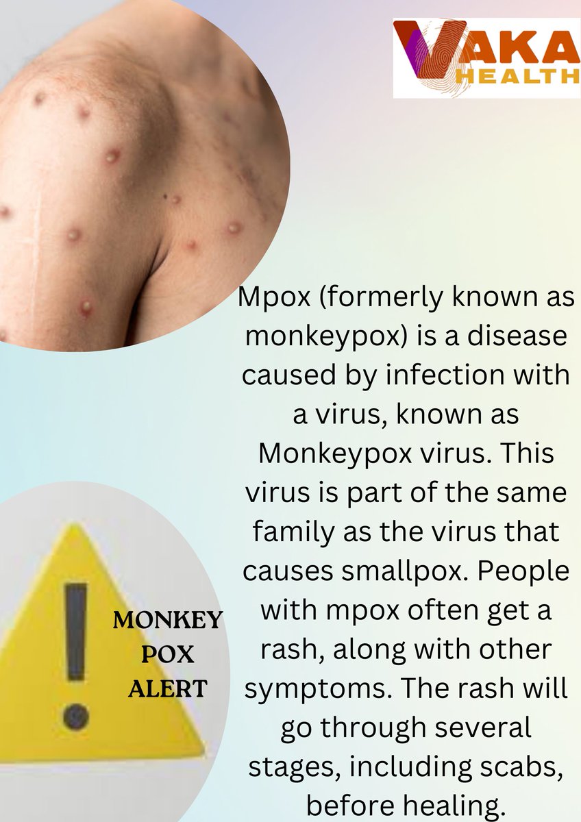 "🚨 Awareness Wednesday: Monkeypox Awareness 

- Rare viral disease, now in 70+ countries
- Symptoms: fever, headache, muscle aches, rash
- Prevent:
    - Wash hands frequently
    - Avoid close contact
    - Get vaccinated (if recommended)