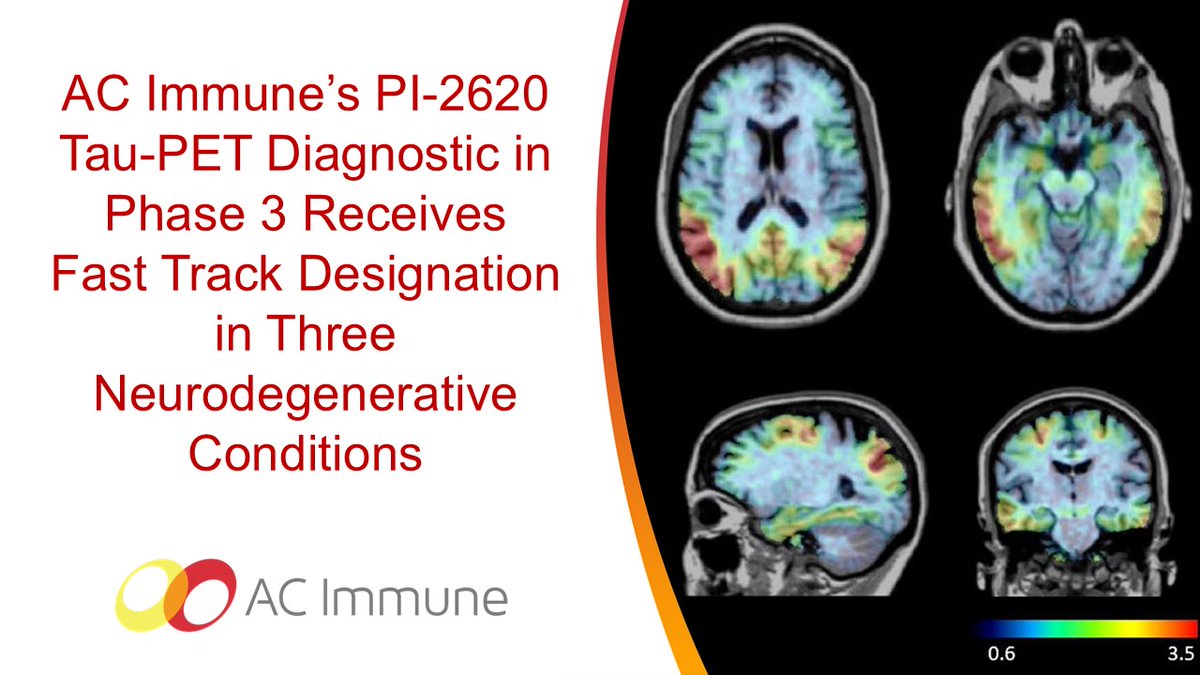 Our collaboration partner <a href="/LifeMolecular/">Life Molecular Imaging</a> Imaging has received Fast Track Designation for our partnered Tau PET-tracer PI-2620 from the <a href="/US_FDA/">U.S. FDA</a>  covering #Alzheimer's disease, progressive supranuclear palsy and corticobasal degeneration.

ir.acimmune.com/news-releases/…

 #fasttrack
